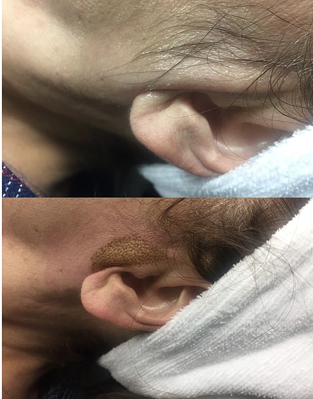 Plexr Before & After