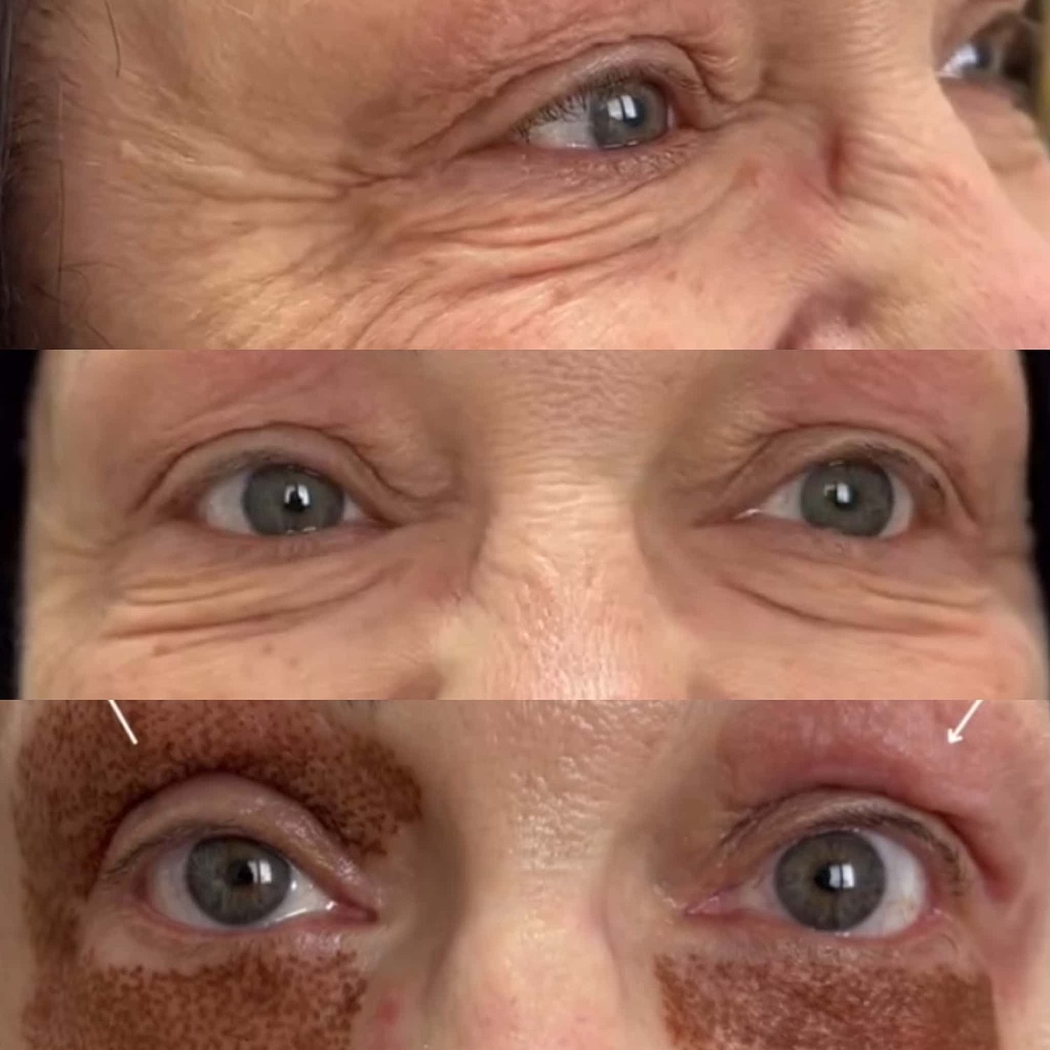 Plexr Before & After