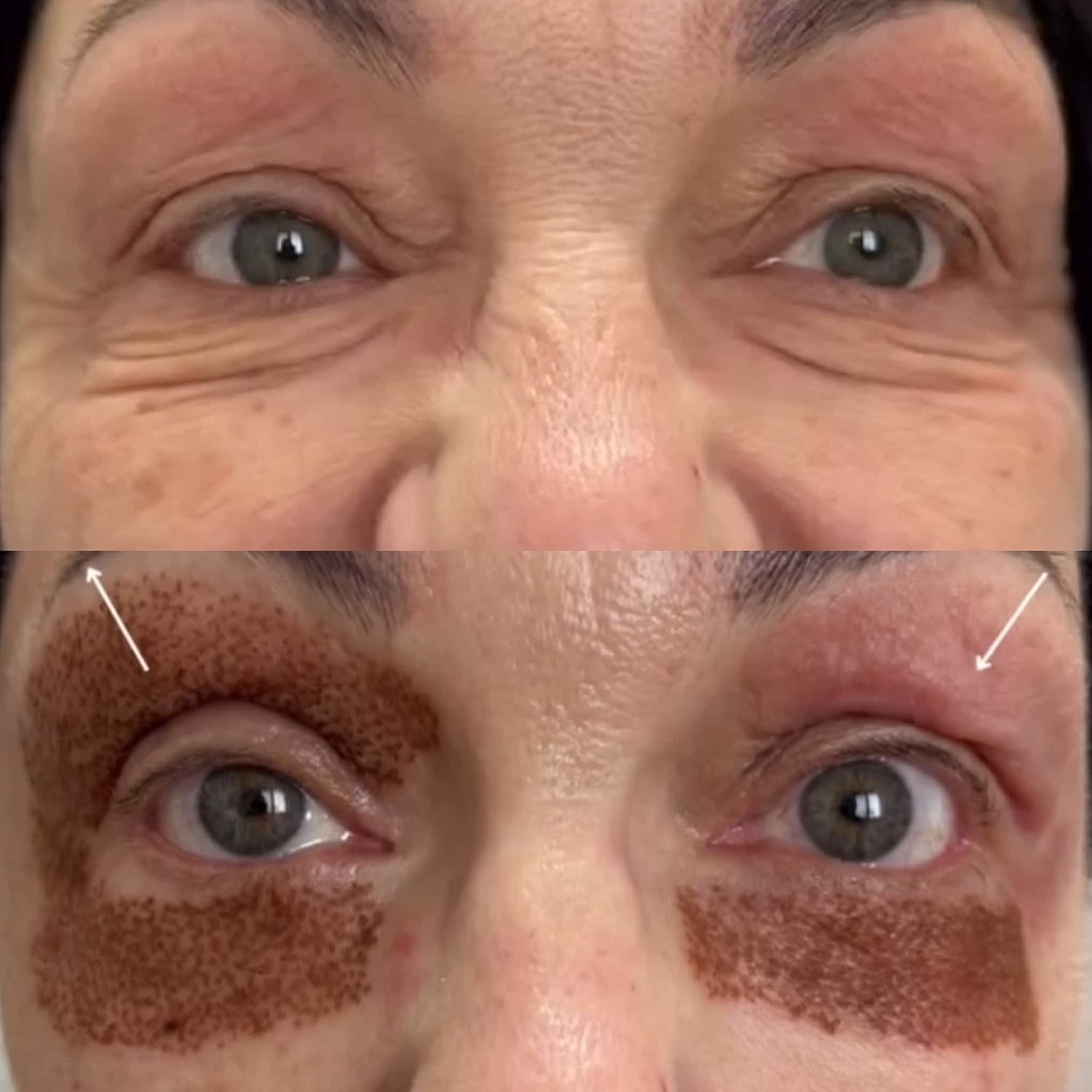 Plexr Before & After