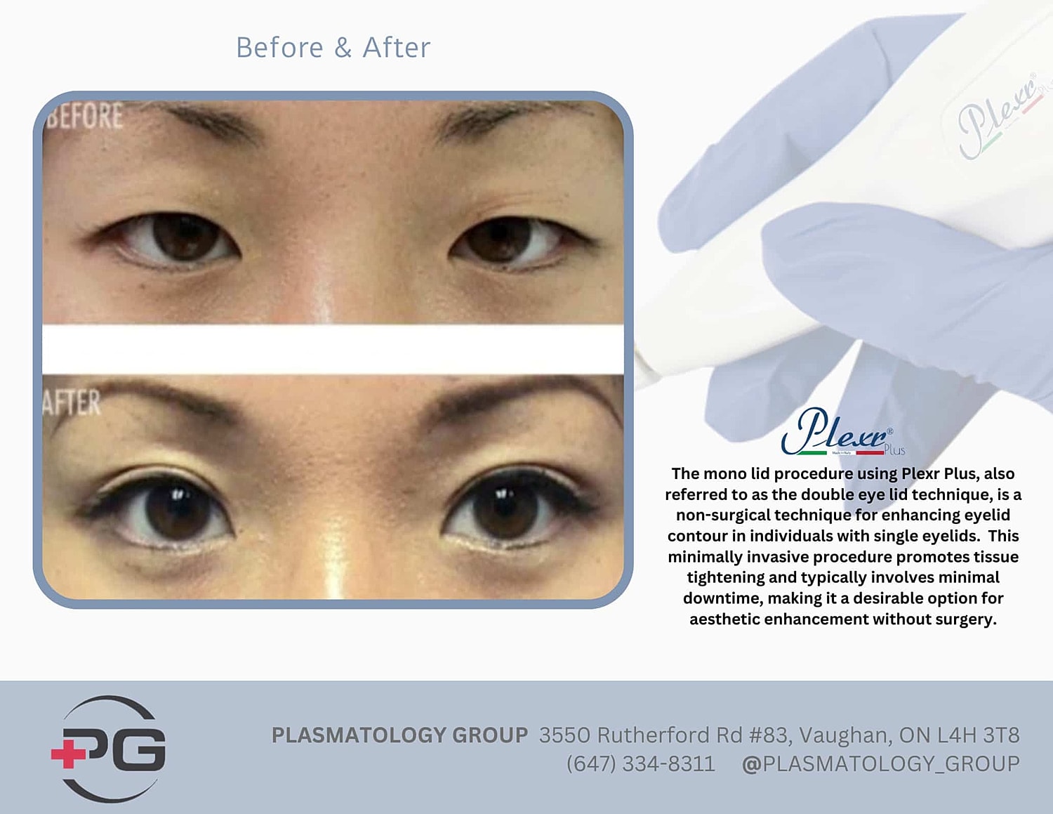 Plexr Before & After