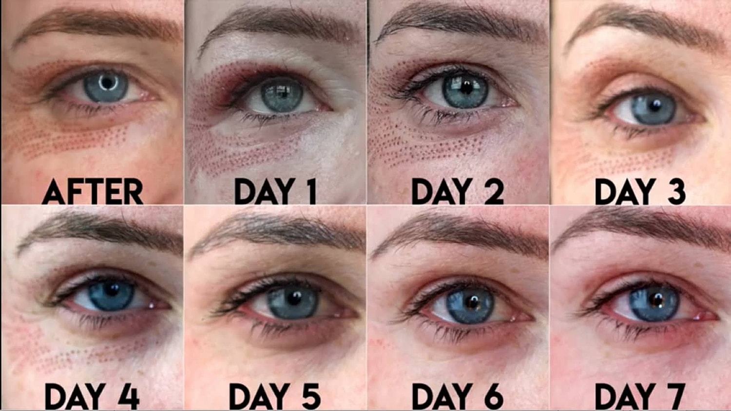 Plexr Before & After