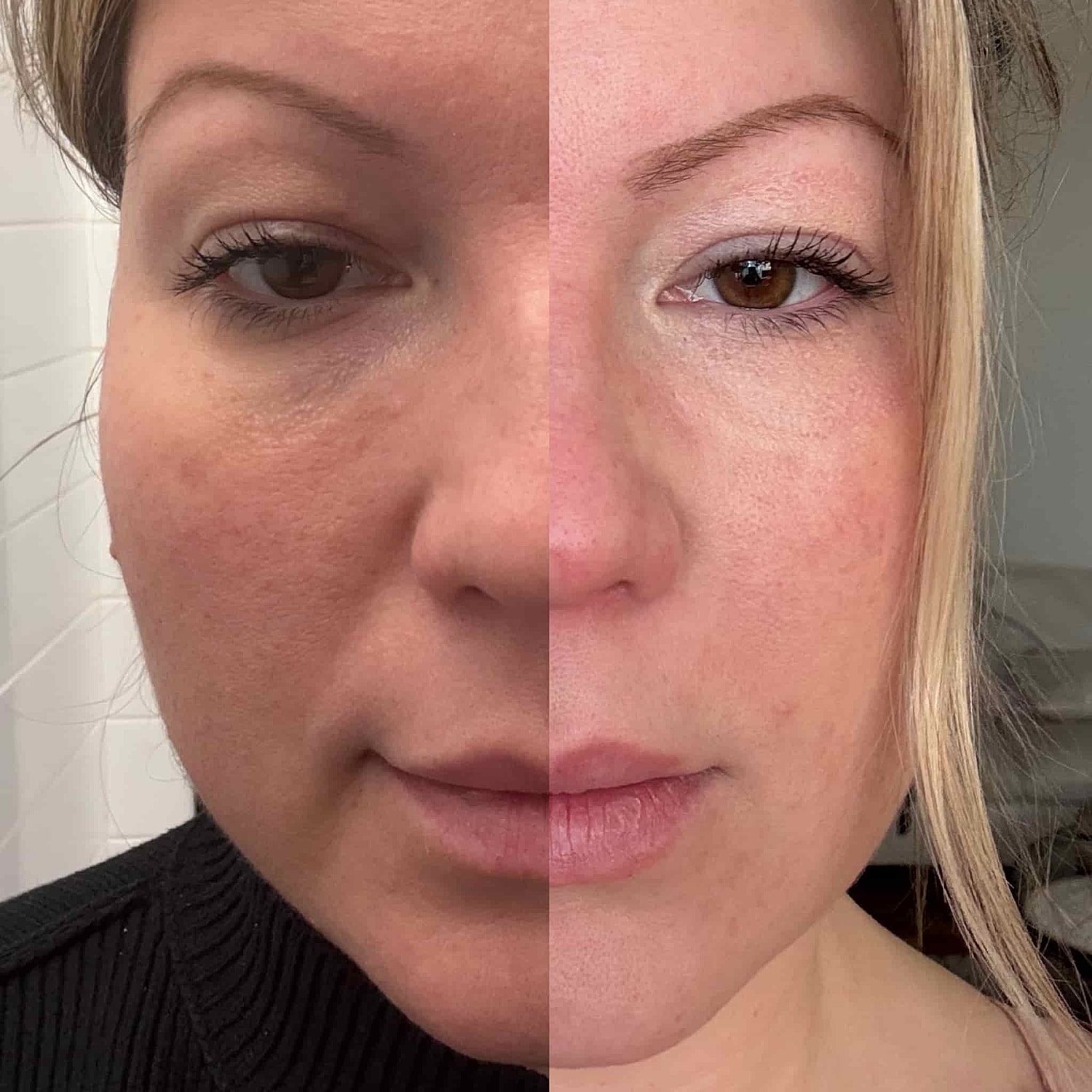 Plexr Before & After