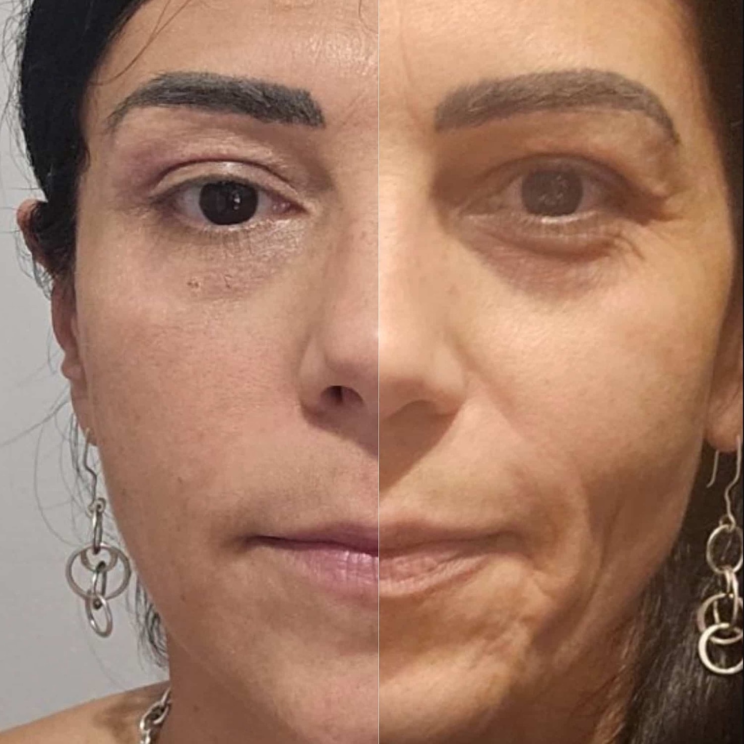 Plexr Before & After