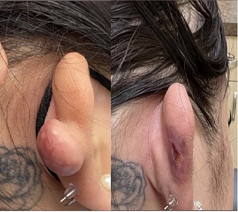 Plexr Before & After